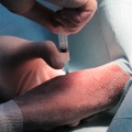 Terapia celular Centro Veterinario Los Álamos Salamanca